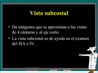 Vista subcostal Da imágenes que se aproximan a las vistas de 4 cámaras y al eje corto La vista subcostal es de ayuda en el examen del SIA e IV. 