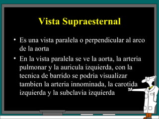 Vista Supraesternal Es una vista paralela o perpendicular al arco de la aorta En la vista paralela se ve la aorta, la arteria pulmonar y la auricula izquierda, con la tecnica de barrido se podria visualizar tambien la arteria innominada, la carotida izquierda y la subclavia izquierda 