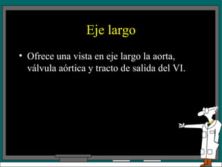 Eje largo Ofrece una vista en eje largo la aorta, válvula aórtica y tracto de salida del VI. 