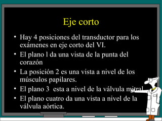 Eje corto Hay 4 posiciones del transductor para los exámenes en eje corto del VI. El plano l da una vista de la punta del corazón La posición 2 es una vista a nivel de los músculos papilares. El plano 3  esta a nivel de la válvula mitral. El plano cuatro da una vista a nivel de la válvula aórtica. 