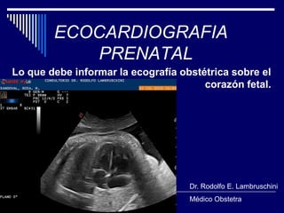ECOCARDIOGRAFIA
PRENATAL
Lo que debe informar la ecografía obstétrica sobre el
corazón fetal.

Dr. Rodolfo E. Lambruschini
Médico Obstetra

 