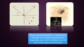 Ecocardiografia modo m | PPTX