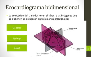 Ecocardiograma bidimensional
• La colocación del transductor en el tórax y las imágenes que
se obtienen se presentan en tres planos ortogonales:
11
Eje corto
Eje largo
Apical
 