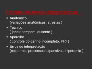 Pontos importantes na indicação clínica de doppler transcraniano____Técnica não invasivaDoenças vasculares primárias ou secundáriaNeurointensiva x ambulatorialOperação e intepretação dependenteVantagens : realizado na beira do leito, repetição, monitorização, menor custo, sem contraste, hemodinâmica cerebralDesvantagens : ausência de janela, não visualização da parede arterial ( também ocorre na angio RNM, arteriografia e etc)   