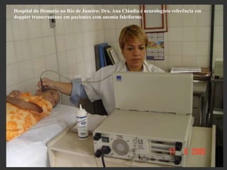 MAV____________________Útil para médio a grande tamanhoDiminuição do IPAumento de VM na artéria nutridoraDiferencia causa de hemorragia não relacionado ao MAV 