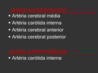 Janela transtemporal_________ Artéria cerebral médiaArtéria carótida internaArtéria cerebral anteriorArtéria cerebral posteriorJanela submandibular_________ Artéria carótida interna