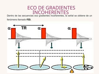 Las Secuencias Eco De Gradiente GRE En Resonancia Magn tica PPTX