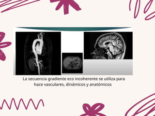 Las secuencias eco de gradiente (GRE) en resonancia magnética | PPTX