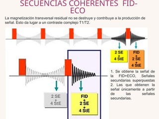 Las secuencias eco de gradiente (GRE) en resonancia magnética | PPTX