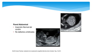 ISUOG Guías Practicas: realización de la exploración ecográfica fetal del primer trimestre. Pag, 14,2013
 