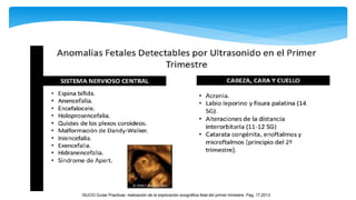 ISUOG Guías Practicas: realización de la exploración ecográfica fetal del primer trimestre. Pag, 17,2013
 