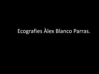 EcoEcografies Àlex Blanco Parras. 
 