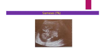 Siameses (1%)
 