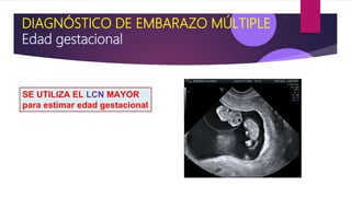 DIAGNÓSTICO DE EMBARAZO MÚLTIPLE
Edad gestacional
SE UTILIZA EL LCN MAYOR
para estimar edad gestacional
 