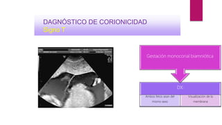 DX:
Ambos fetos sean del
mismo sexo
Visualización de la
membrana
Gestación monocorial biamniótica
DAGNÓSTICO DE CORIONICIDAD
Signo T
 