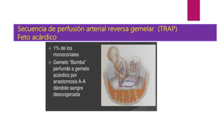 Secuencia de perfusión arterial reversa gemelar (TRAP)
Feto acárdico
 