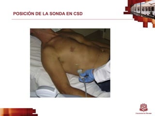POSICIÓN DE LA SONDA EN CSD
 