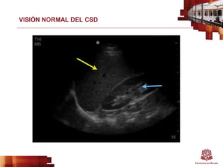 VISIÓN NORMAL DEL CSD
 