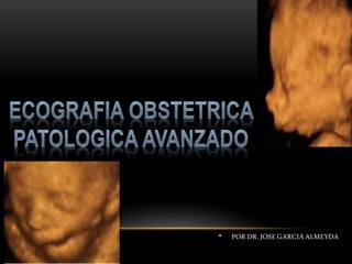 • POR DR. JOSE GARCIA ALMEYDA
 