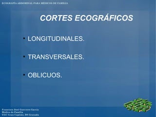 Eco Generalidades