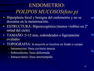 ENDOMETRIO:
         POLIPOS MUCOSOS(foto p)
• Hiperplasia focal y benigna del endometrio y no se
  descama en la menstruación.
• ESTRUCTURA: Hiperecogénica (menos visibles en 2ª
  mitad del ciclo)
• TAMAÑO :5-15 mm, redondeados o ligeramente
  ovalados
• TOPOGRAFIA: la mayoría se localiza en fondo o cuerpo
   – Intramucoso: línea cavitaria intacta
   – Sobresaliente: línea deformada
   – Intracavitario: línea interrumpida

                                                   16
 