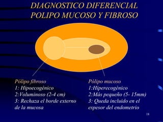 DIAGNOSTICO DIFERENCIAL
      POLIPO MUCOSO Y FIBROSO




Pólipo fibroso                Pólipo mucoso
1: Hipoecogénico              1:Hiperecogénico
2:Voluminoso (2-4 cm)         2:Más pequeño (5- 15mm)
3: Rechaza el borde externo   3: Queda incluido en el
de la mucosa                  espesor del endometrio
                                                    18
 