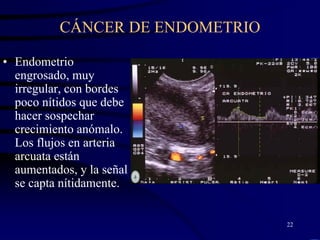 CÁNCER DE ENDOMETRIO

• Endometrio
  engrosado, muy
  irregular, con bordes
  poco nítidos que debe
  hacer sospechar
  crecimiento anómalo.
  Los flujos en arteria
  arcuata están
  aumentados, y la señal
  se capta nítidamente.


                                 22
 