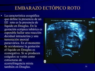 EMBARAZO ECTÓPICO ROTO
• La característica ecográfica
  que define la presencia de un
  EE roto es la presencia de
  líquido en Douglas. En la
  gestación ectópica tubárica es
  esperable hallar una reacción
  decidual intrauterina y una
  tumoración anexial
  paraovárica. En el momento
  de accidentarse la gestación
  el líquido en Douglas es
  econegativo. Si se producen
  coágulos se verán como
  estructuras de
  ecorrefringencia mixta
  también en Douglas.              30
 