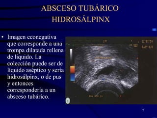 ABSCESO TUBÁRICO
                  HIDROSÁLPINX

• Imagen econegativa
  que corresponde a una
  trompa dilatada rellena
  de líquido. La
  colección puede ser de
  líquido aséptico y sería
  hidrosálpinx, o de pus
  y entonces
  correspondería a un
  absceso tubárico.

                                   7
 