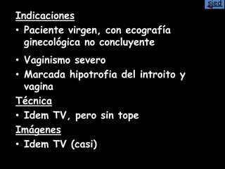 Indicaciones
• Paciente virgen, con ecografía
ginecológica no concluyente
• Vaginismo severo
• Marcada hipotrofia del introito y
vagina
Técnica
• Idem TV, pero sin tope
Imágenes
• Idem TV (casi)