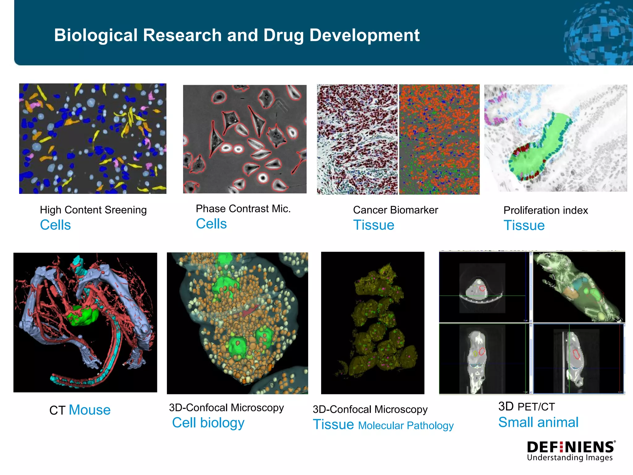 Phase Contrast Mic. Cells 3D-Confocal Microscopy   Cell biology 3D-Confocal Microscopy  Tissue  Molecular Pathology 3D  PET/CT  Small animal Biological Research and Drug Development CT   Mouse High Content Sreening Cells Proliferation index Tissue Cancer Biomarker Tissue 