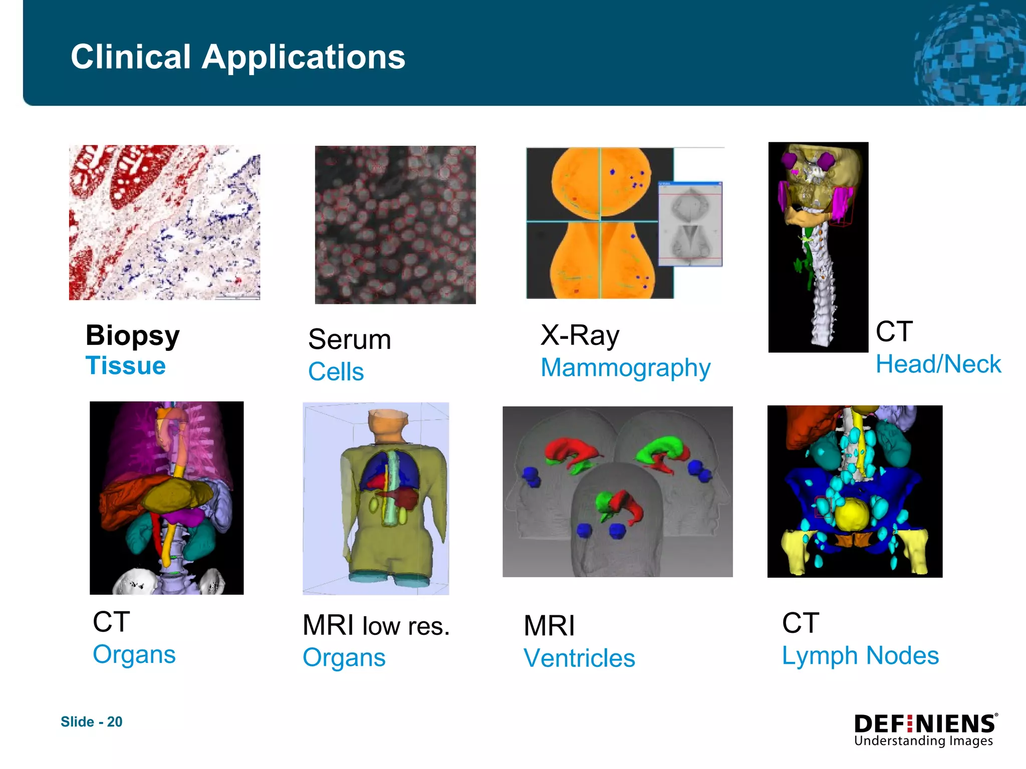 Biopsy Tissue Clinical Applications Serum Cells X-Ray Mammography CT Organs MRI  low res. Organs CT Head/Neck MRI Ventricles CT Lymph Nodes 