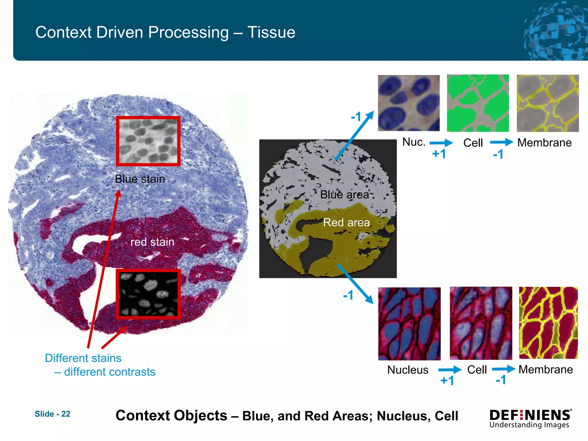 Context   Objects  – Blue, and Red Areas; Nucleus, Cell Blue stain red stain Different stains    – different contrasts Blue area Red area -1 -1 Nucleus Cell Membrane +1 -1 Nuc. Cell Membrane +1 -1 Context Driven Processing – Tissue 