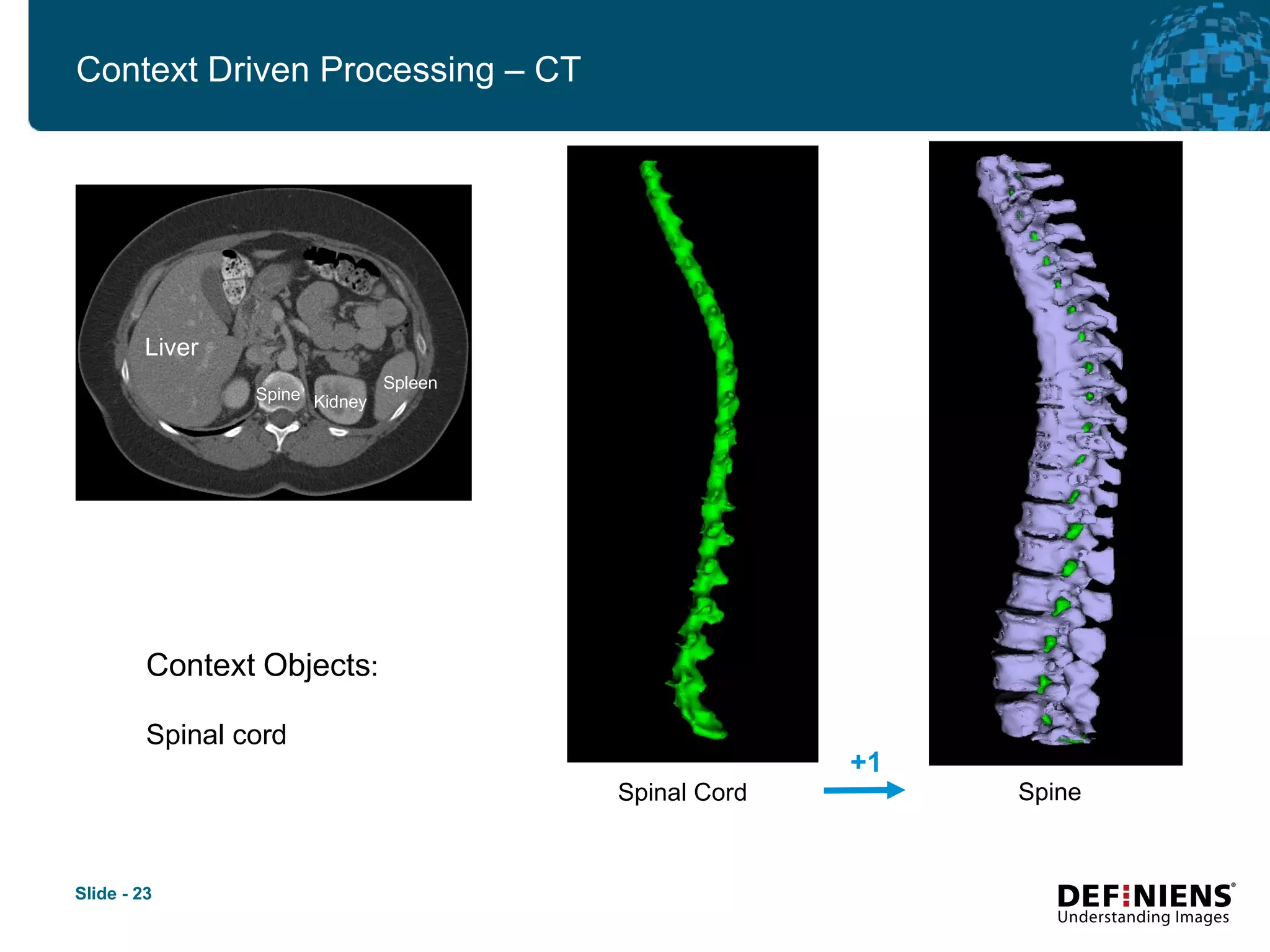 Spinal Cord +1 Context Driven Processing – CT Spine Context   Objects :  Spinal cord Liver Kidney Spleen Spine 