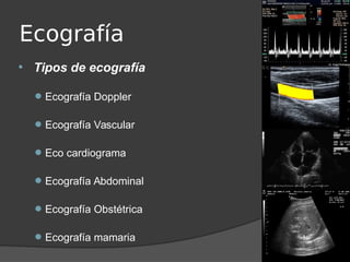 Ecografía
 Tipos de ecografía
Ecografía Doppler
Ecografía Vascular
Eco cardiograma
Ecografía Abdominal
Ecografía Obstétrica
Ecografía mamaria
 