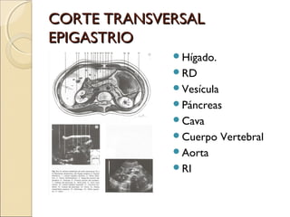 CORTE TRANSVERSALCORTE TRANSVERSAL
EPIGASTRIOEPIGASTRIO
Hígado.
RD
Vesícula
Páncreas
Cava
Cuerpo Vertebral
Aorta
RI
 