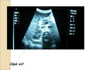 ¿Qué es?
 