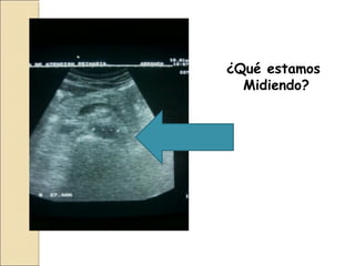 ¿Qué estamos
Midiendo?
 