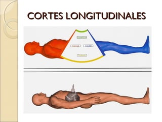 CORTES LONGITUDINALESCORTES LONGITUDINALES
 