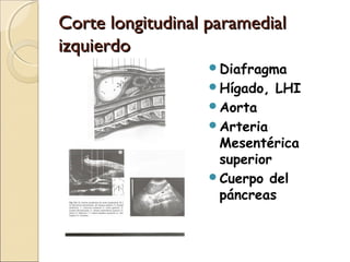 Corte longitudinal paramedialCorte longitudinal paramedial
izquierdoizquierdo
Diafragma
Hígado, LHI
Aorta
Arteria
Mesentérica
superior
Cuerpo del
páncreas
 