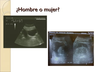 ¿Hombre o mujer?¿Hombre o mujer?
 
