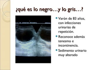 ¿qué es lo negro…y lo gris…?¿qué es lo negro…y lo gris…?
Varón de 83 años,
con infecciones
urinarias de
repetición.
Reconoce además
tenesmo e
incontinencia.
Sedimento urinario
muy alterado
 