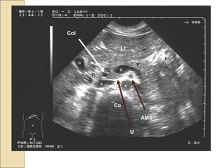 C
P
E
V
LI
G
A
Co
Col
D
E
U
AMS
 