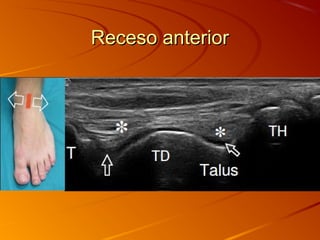 Receso anteriorReceso anterior
 