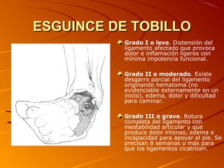 ESGUINCE DE TOBILLOESGUINCE DE TOBILLO
Grado I o leve. Distensión del
ligamento afectado que provoca
dolor e inflamación ligeros con
mínima impotencia funcional.
Grado II o moderado. Existe
desgarro parcial del ligamento
originando hematoma (no
evidenciable externamente en un
inicio), edema, dolor y dificultad
para caminar.
Grado III o grave. Rotura
completa del ligamento con
inestabilidad articular y que
produce dolor intenso, edema e
incapacidad para apoyar el pie. Se
precisan 8 semanas o más para
que los ligamentos cicatricen.
 