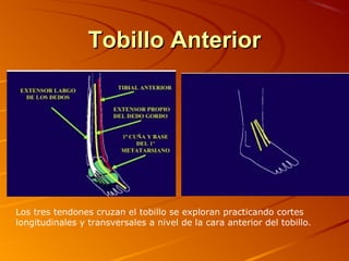 Tobillo AnteriorTobillo Anterior
Los tres tendones cruzan el tobillo se exploran practicando cortes
longitudinales y transversales a nivel de la cara anterior del tobillo.
 