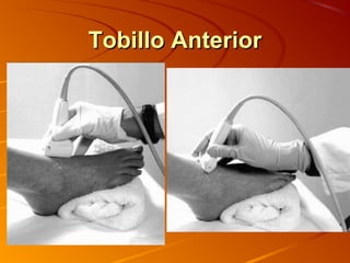 Tobillo AnteriorTobillo Anterior
 