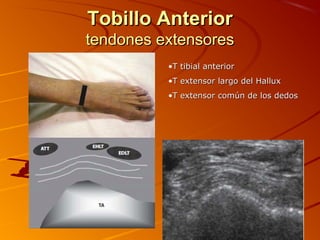 Tobillo AnteriorTobillo Anterior
tendones extensorestendones extensores
•T tibial anteriorT tibial anterior
•T extensor largo del HalluxT extensor largo del Hallux
•T extensor común de los dedosT extensor común de los dedos
 
