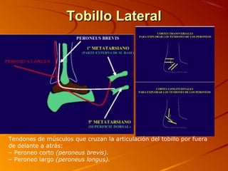 Tobillo LateralTobillo Lateral
Tendones de músculos que cruzan la articulación del tobillo por fuera
de delante a atrás:
– Peroneo corto (peroneus brevis).
– Peroneo largo (peroneus longus).
 