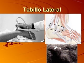 Tobillo LateralTobillo Lateral
 